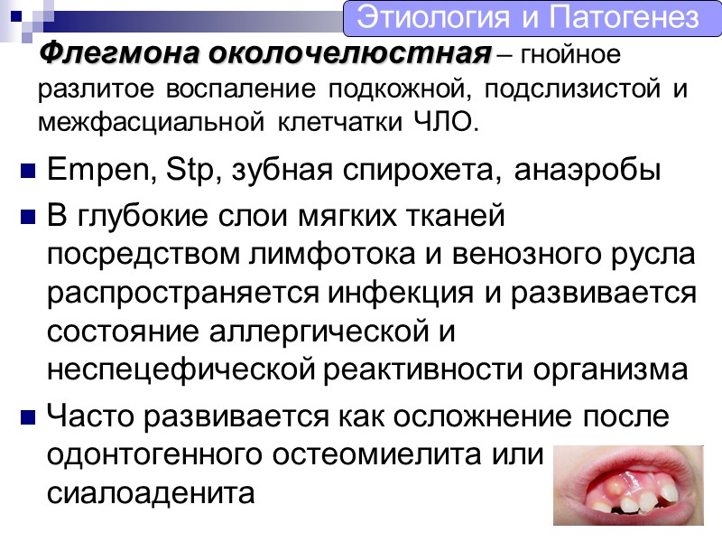 Флегмона околочелюстная – гнойное разлитое воспаление подкожной, подслизистой и межфасциальной клетчатки ЧЛО. Empen, Stp,